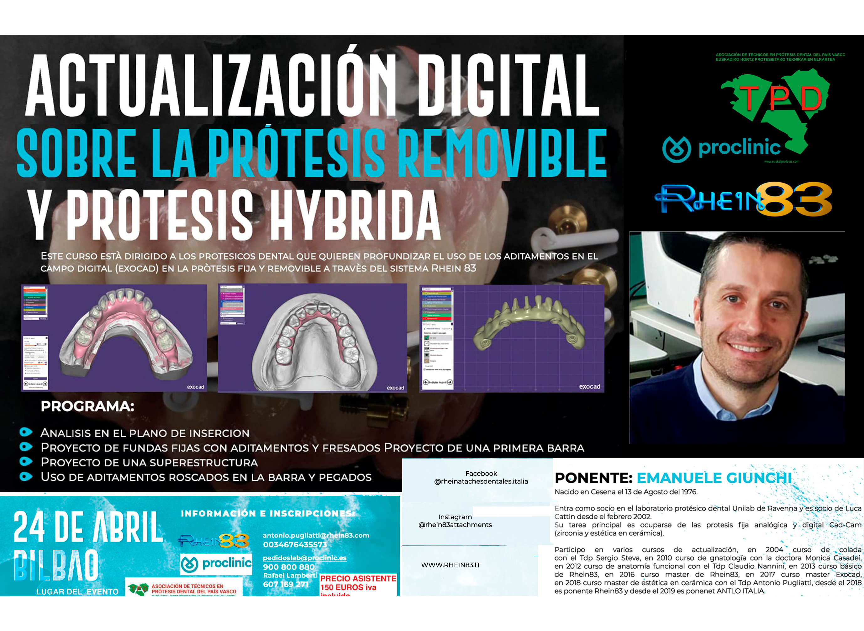 Actualización Digital   Prótesis Removible