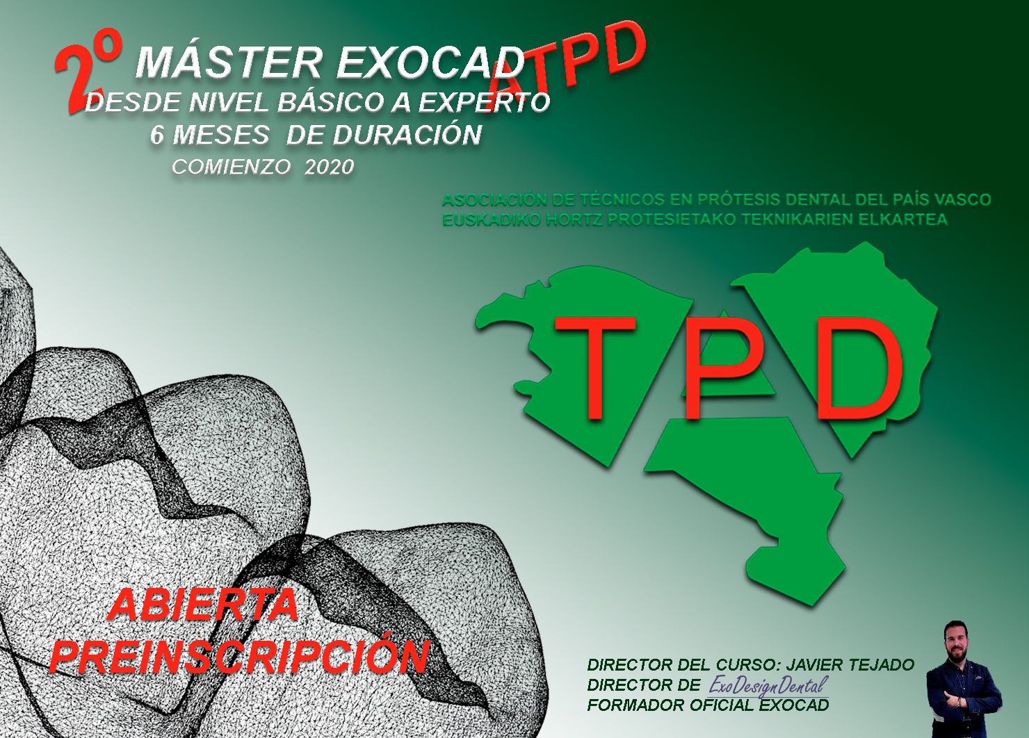 2ºMASTER EXOCAD ATPD  (COMPLETO)