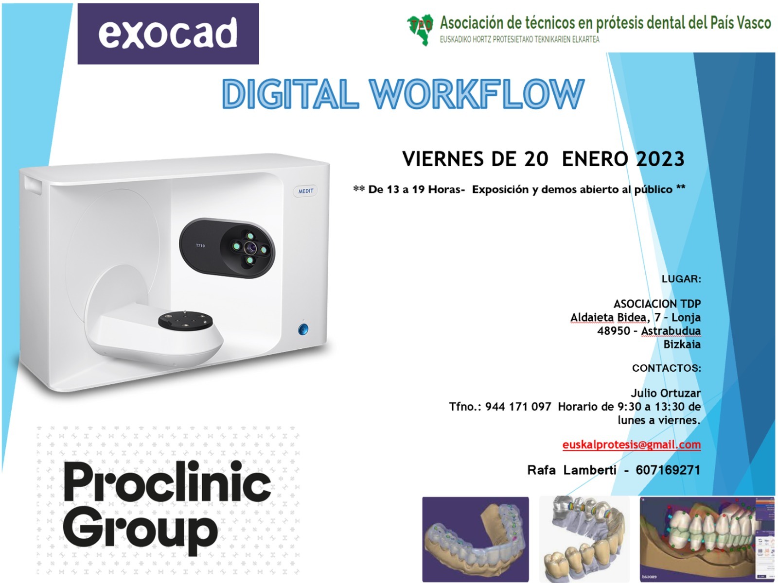 Digital Workflow Exocad